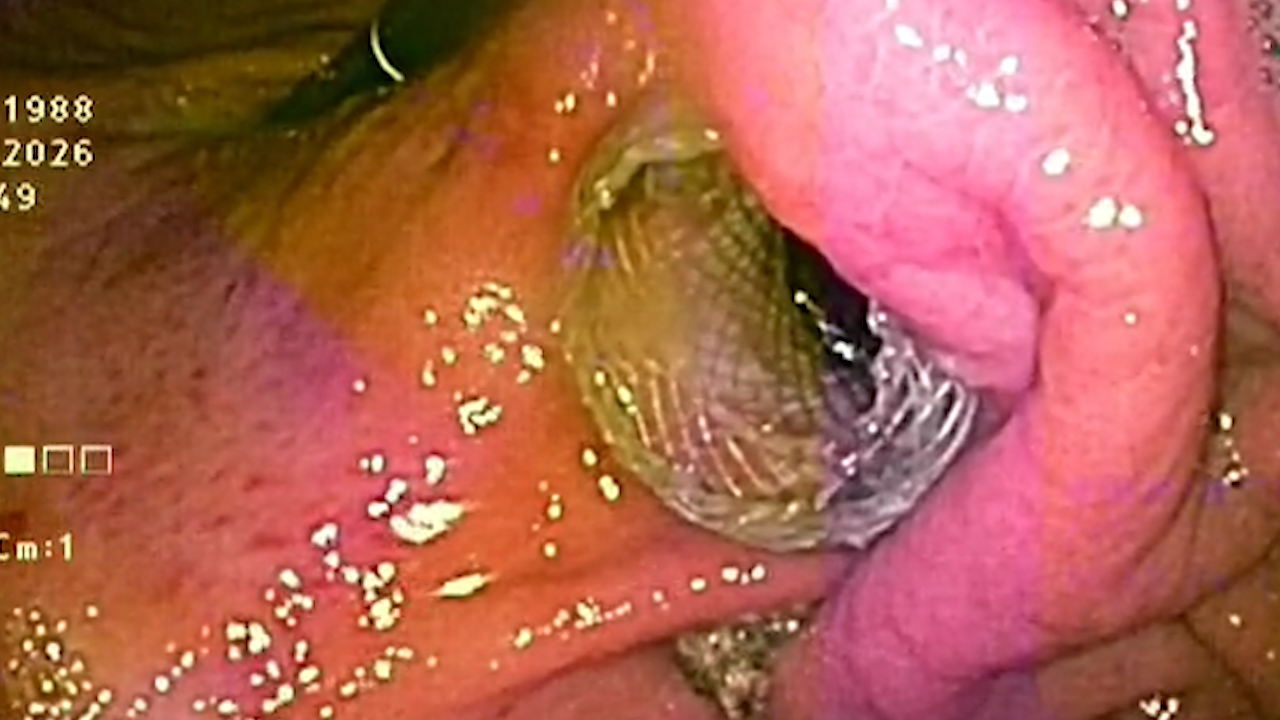 Foto 9